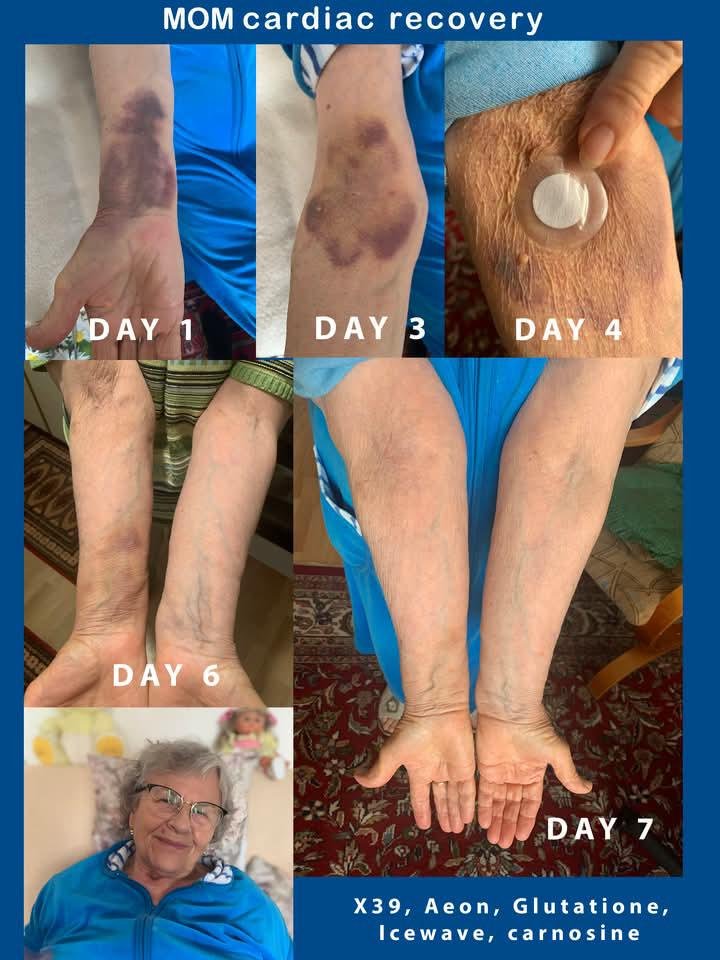 Mom cardiac recovery progression Day 1 to Day 7